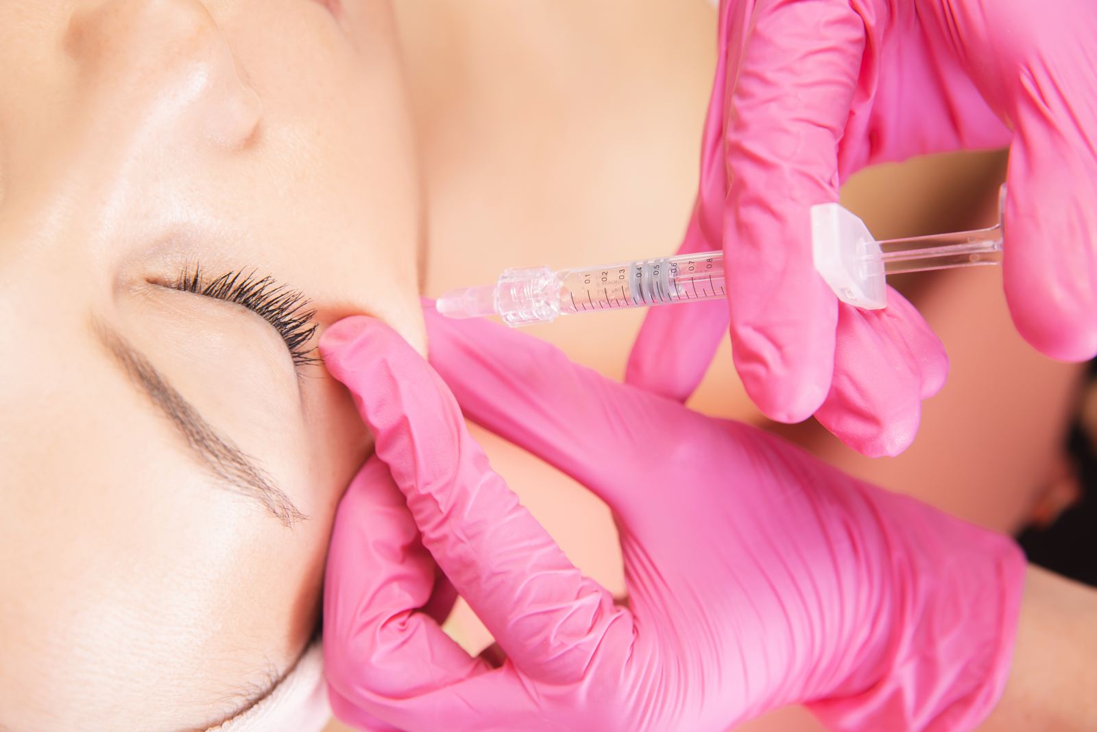 Microneedling with PRP